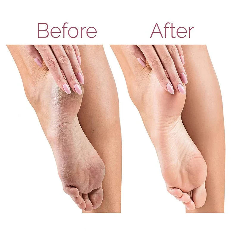 Ujala Electric Pedicure Foot File Callus Remover