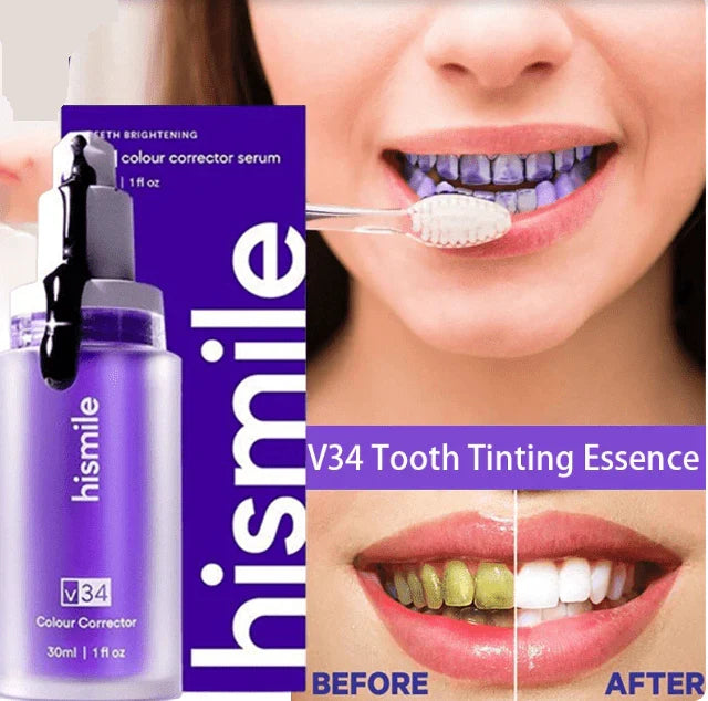 Ujala - Teeth Brightening Serum V34